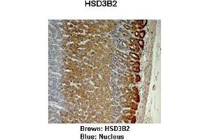 Image no. 3 for anti-Hydroxy-delta-5-Steroid Dehydrogenase, 3 beta- and Steroid delta-Isomerase 2 (HSD3B2) (N-Term) antibody (ABIN2781776)