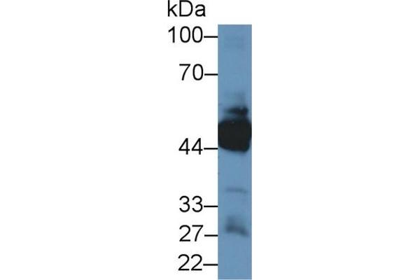Keratin 33A Antikörper  (AA 57-363)