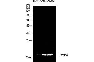 Image no. 3 for anti-Glycophorin A (GYPA) (Internal Region) antibody (ABIN3181476)