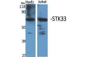 Image no. 2 for anti-serine/threonine Kinase 33 (STK33) (N-Term) antibody (ABIN3187099)