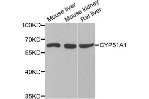 Image no. 2 for anti-Cytochrome P450, Family 51, Subfamily A, Polypeptide 1 (CYP51A1) antibody (ABIN6570314)