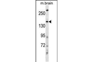 Image no. 1 for anti-HECT, C2 and WW Domain Containing E3 Ubiquitin Protein Ligase 2 (HECW2) (AA 848-876) antibody (ABIN5531129)