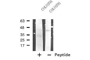 Image no. 1 for anti-Ribonucleotide Reductase M2 B (TP53 Inducible) (RRM2B) antibody (ABIN6257482)