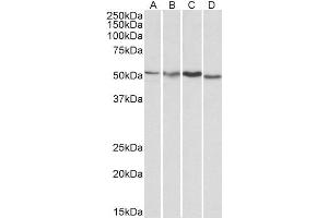 Image no. 1 for anti-V-Akt Murine Thymoma Viral Oncogene Homolog 3 (Protein Kinase B, Gamma) (AKT3) (Internal Region) antibody (ABIN185314)