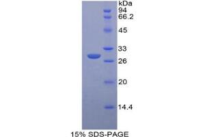 Image no. 1 for Insulin-Like Growth Factor 2 Receptor (IGF2R) protein (ABIN3009981)