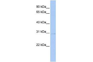 Image no. 1 for anti-serine/threonine Kinase 16 (STK16) (Middle Region) antibody (ABIN2783292)