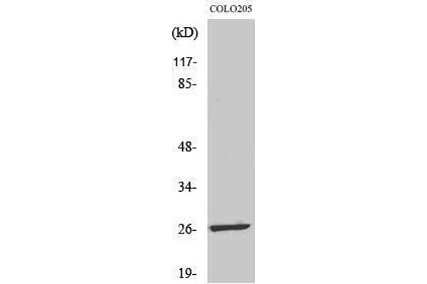LDOC1L anticorps  (Internal Region)