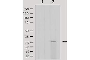Image no. 3 for anti-Mitochondrial Ribosomal Protein L16 (MRPL16) (Internal Region) antibody (ABIN6258514)