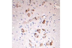 Image no. 2 for anti-Solute Carrier Family 18 (Vesicular Acetylcholine), Member 3 (SLC18A3) (Internal Region) antibody (ABIN571639)
