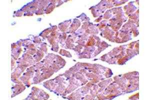 Image no. 3 for anti-Transient Receptor Potential Cation Channel, Subfamily C, Member 3 (TRPC3) (C-Term) antibody (ABIN6655766)