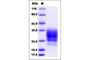 Image no. 1 for Ribonuclease, RNase A Family, 1 (Pancreatic) (RNASE1) (AA 1-156) protein (His tag) (ABIN2005723)