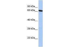 Image no. 1 for anti-UDP-N-Acetyl-alpha-D-Galactosamine:polypeptide N-Acetylgalactosaminyltransferase 14 (GalNAc-T14) (GALNT14) (N-Term) antibody (ABIN2784110)