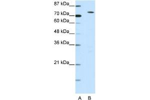 Image no. 1 for anti-MYST Histone Acetyltransferase 2 (MYST2) (N-Term) antibody (ABIN2777626)