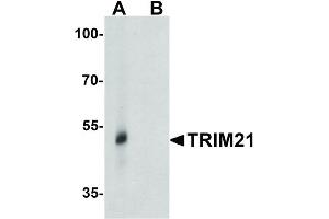 Image no. 2 for anti-Tripartite Motif Containing 21 (TRIM21) (Internal Region) antibody (ABIN6655437)
