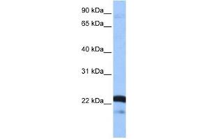 Image no. 1 for anti-serine/arginine-Rich Splicing Factor 9 (SFRS9) (Middle Region) antibody (ABIN633457)