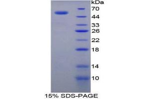 Image no. 1 for Transglutaminase 1, Keratinocyte (TGM1) (AA 504-737) protein (His tag,GST tag) (ABIN1879486)