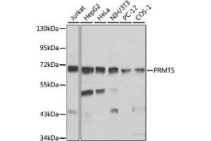 Image no. 4 for anti-Protein Arginine Methyltransferase 5 (PRMT5) antibody (ABIN6568604)