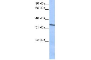 Image no. 1 for anti-Septin 9 (SEPT9) (C-Term) antibody (ABIN2784607)