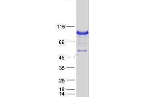 Image no. 1 for Epsin 1 (EPN1) (Transcript Variant 3) protein (Myc-DYKDDDDK Tag) (ABIN2720345)
