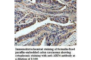 Image no. 1 for anti-ADP-Ribosylation Factor 4 (ARF4) antibody (ABIN6584284)