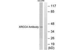 Image no. 1 for anti-Disrupted in Renal Carcinoma 2 (DIRC2) (AA 261-310) antibody (ABIN1533467)