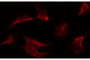 Image no. 2 for anti-Mitogen-Activated Protein Kinase 15 (MAPK15) (pThr175), (pTyr177) antibody (ABIN6256658)