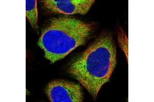 Image no. 3 for anti-Zinc Finger CCCH-Type Containing 15 (ZC3H15) antibody (ABIN5591169)