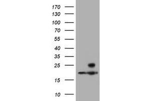 Image no. 2 for anti-Proteasome (Prosome, Macropain) Subunit, beta Type, 9 (Large Multifunctional Peptidase 2) (PSMB9) (AA 21-219) antibody (ABIN2729952)