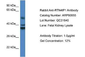 Image no. 1 for anti-Reticulon 4 Interacting Protein 1 (RTN4IP1) (Middle Region) antibody (ABIN2788527)