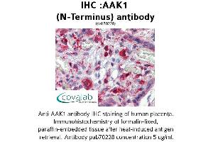 Image no. 1 for anti-AP2 associated kinase 1 (AAK1) (N-Term) antibody (ABIN1731399)