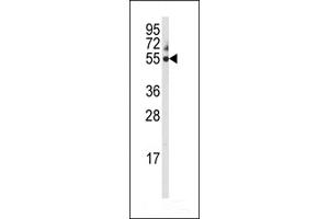 Western Blotting (WB) image for anti-Cytochrome P450, Family 3, Subfamily A, Polypeptide 5 (CYP3A5) antibody (ABIN2158459)