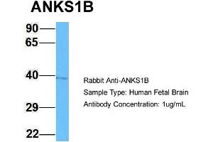 Image no. 2 for anti-Ankyrin Repeat and Sterile alpha Motif Domain Containing 1B (ANKS1B) (C-Term) antibody (ABIN2790321)