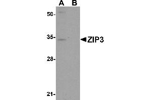 Image no. 2 for anti-Solute Carrier Family 39 (Zinc Transporter), Member 3 (SLC39A3) (Middle Region) antibody (ABIN1031179)