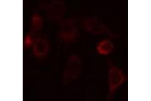 Image no. 1 for anti-Diacylglycerol Kinase, iota (DGKI) (C-Term) antibody (ABIN6257144)