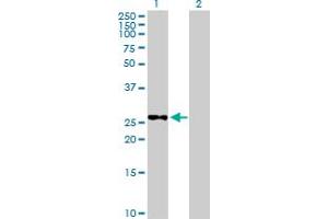 Image no. 1 for anti-Methyltransferase Like 6 (METTL6) (AA 1-255) antibody (ABIN530677)