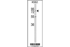 Western Blotting (WB) image for anti-Carboxypeptidase Z (CPZ) antibody (ABIN2158356)