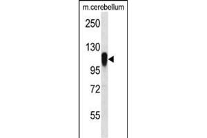 FBXO41 antibody  (N-Term)