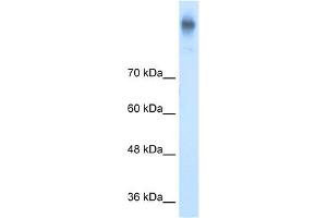 Image no. 2 for anti-Solute Carrier Family 12 (Potassium-Chloride Transporter) Member 2 (SLC12A2) (C-Term) antibody (ABIN2773831)