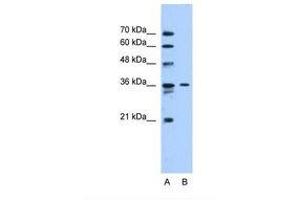 Image no. 1 for anti-Solute Carrier Family 35 (UDP-N-Acetylglucosamine (UDP-GlcNAc) Transporter), Member A3 (SLC35A3) (AA 151-200) antibody (ABIN6738101)