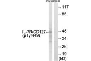 Western blot analysis of extracts from COLO205 cells, using IL-7R/CD127 (Phospho-Tyr449) Antibody.
