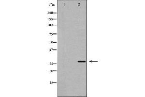 Image no. 4 for anti-Tumor Necrosis Factor (Ligand) Superfamily, Member 12 (TNFSF12) (N-Term) antibody (ABIN6265650)