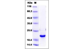Image no. 1 for Dual Specificity Phosphatase 3 (DUSP3) (AA 1-185) (Active) protein (ABIN2002103)