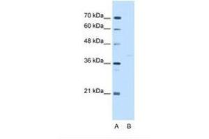 Image no. 2 for anti-GDP-Mannose Pyrophosphorylase B (GMPPB) (C-Term) antibody (ABIN321530)