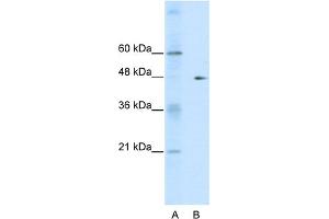 Image no. 1 for anti-GDP Dissociation Inhibitor 2 (GDI2) (C-Term) antibody (ABIN2792268)