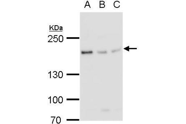anti-Bloom Syndrome RecQ Like Helicase (BLM) (N-Term) antibody