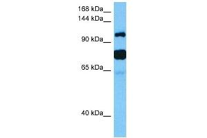 Image no. 3 for anti-Histone Deacetylase 4 (HDAC4) (Middle Region) antibody (ABIN2778342)
