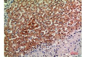 Immunohistochemistry (IHC) analysis of paraffin-embedded Human Liver, antibody was diluted at 1:200.