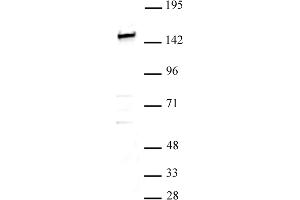 SMARCC1 / BAF155 antibody (pAb) tested by Western blot.