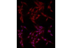 FABP5 antibody  (AA 1-135)