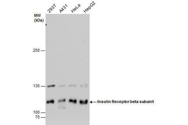 anti-Insulin Receptor (INSR) (C-Term) antibody